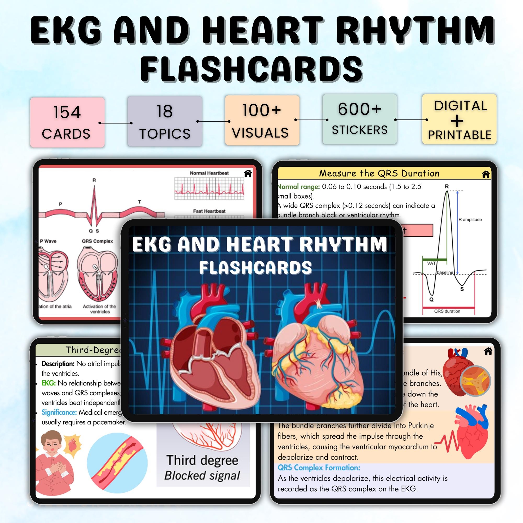 150 EKG And Heart Rhythm Flashcards EKG Study Guide ECG Or Ekg Interpretation Cardiac Study Guide Ekg Rhythms Nursing Notes Etsy 150 EKG And Heart Rhythm Flashcards EKG Study Guide ECG Or Ekg Interpretation Cardiac Study Guide Ekg Rhythms Nursing Notes Etsy