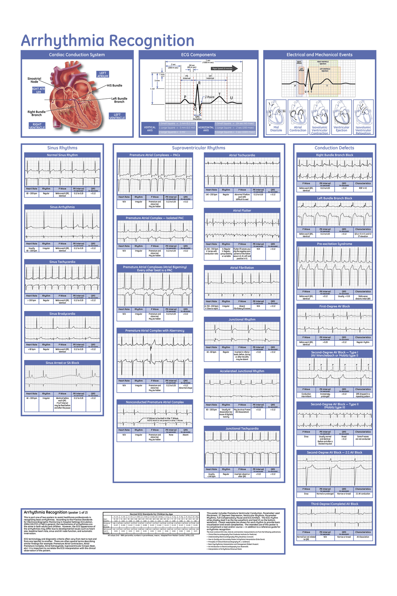 Free Printable Arrythmia Worksheet Free Printable Arrythmia Worksheet