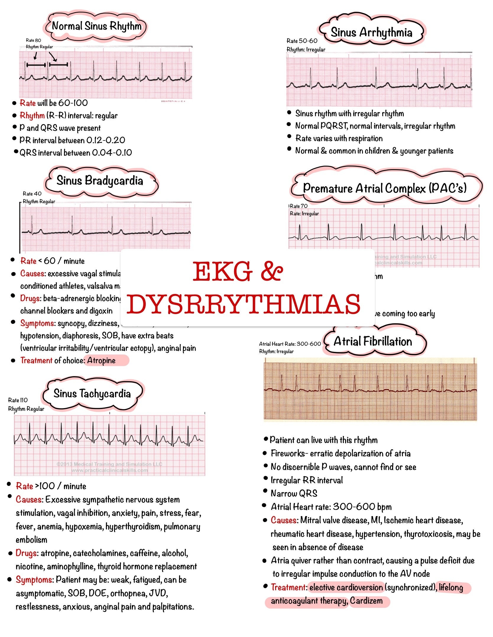 Basic EKG Dysrhythmias U0026 Interpretation Nursing Notes 6 PAGES Digital Download PDF Etsy Basic EKG Dysrhythmias U0026 Interpretation Nursing Notes 6 PAGES Digital Download PDF Etsy