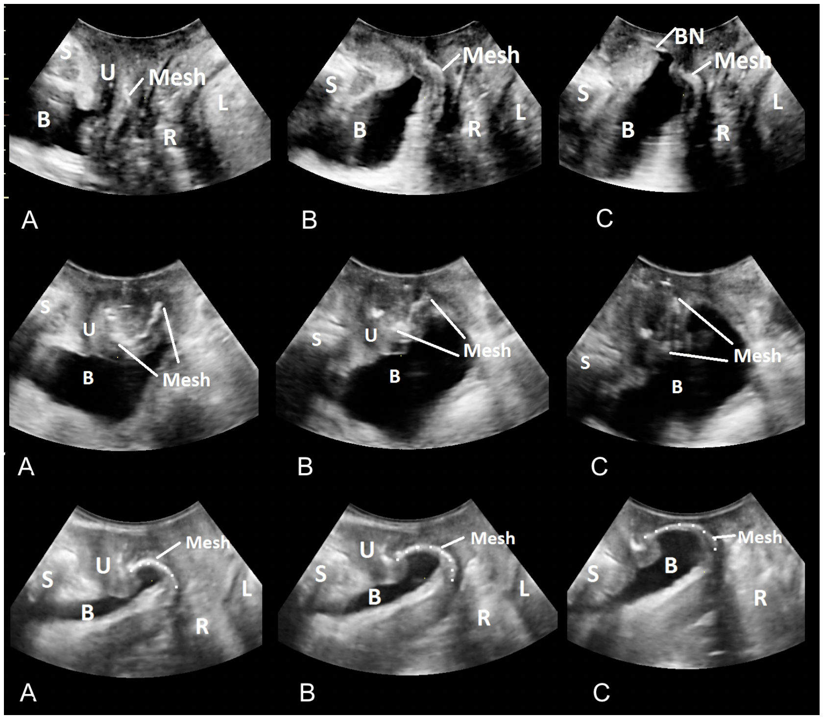 GE Voluson Club Ultrasound Practice Guidelines GE Voluson Club Ultrasound Practice Guidelines